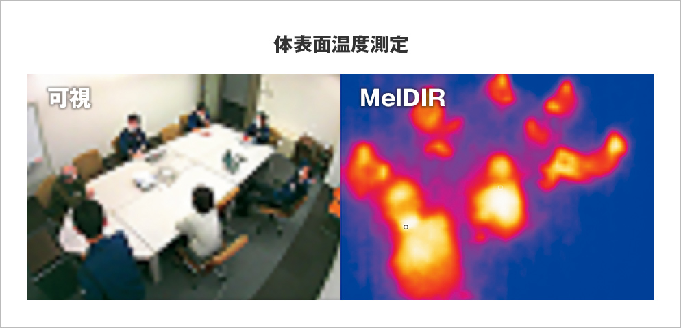 体表面温度測定のMelDIR画像